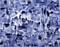 Art: Blue Ice  by Artist Diane G. Casey